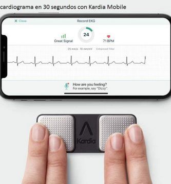 Kardia Mobile electrocardiograma